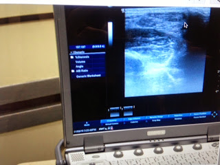 Arlington Foot And Ankle Ultrasound